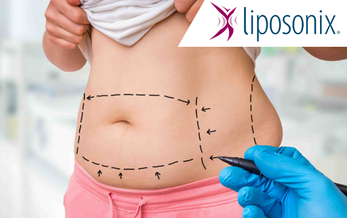 Laserová liposukce Verjú